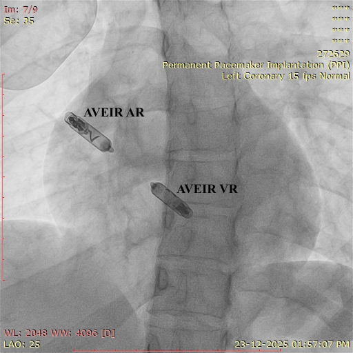 World’s First Dual-Chamber Leadless Pacemaker